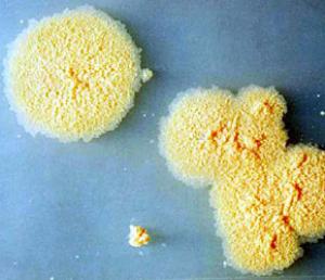 Mycobacterium Vaccae Mycobacterium Vaccae