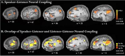 neural coupling